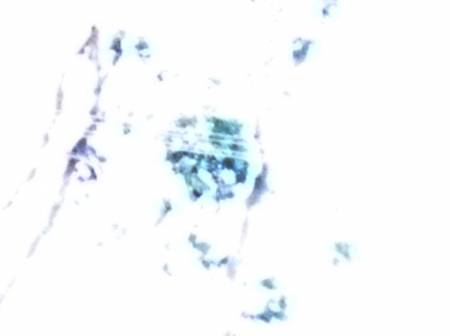 whiteout_eye7834d.jpg