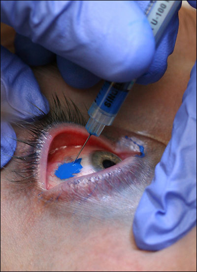 Attached picture eye_tat.jpg